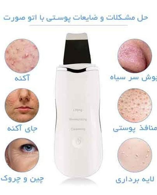 اتو صورت رفع لک و جوش های سر سیاه اورجینال مدل MUTE 8818